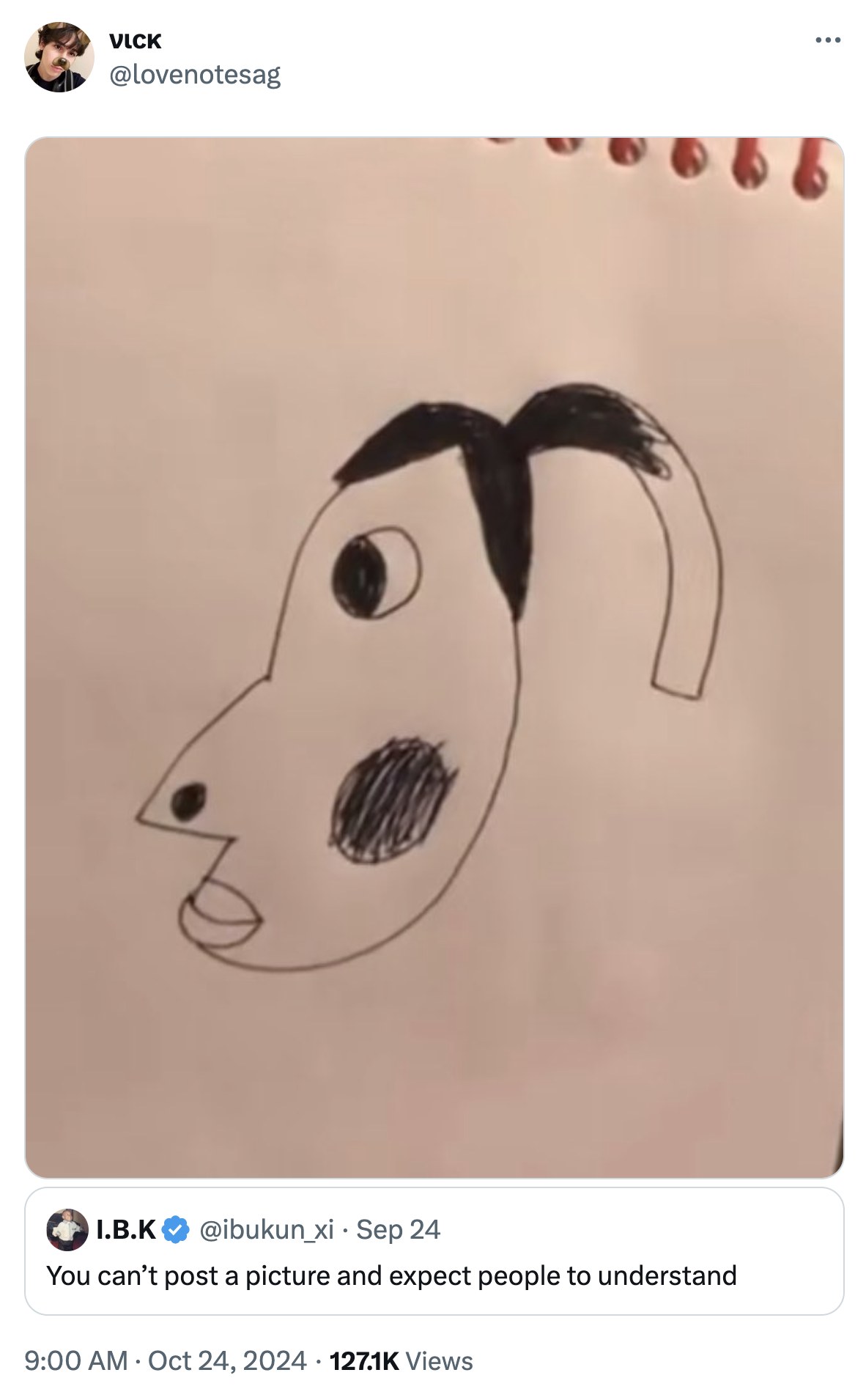 Tosco retrato aficionado a bolígrafo usado como base del meme de la hiperpigmentación